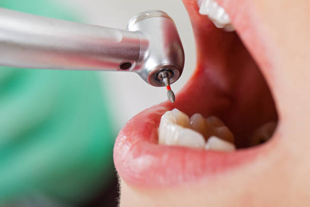 Best Emergency Gum Treatment in Amory, MS